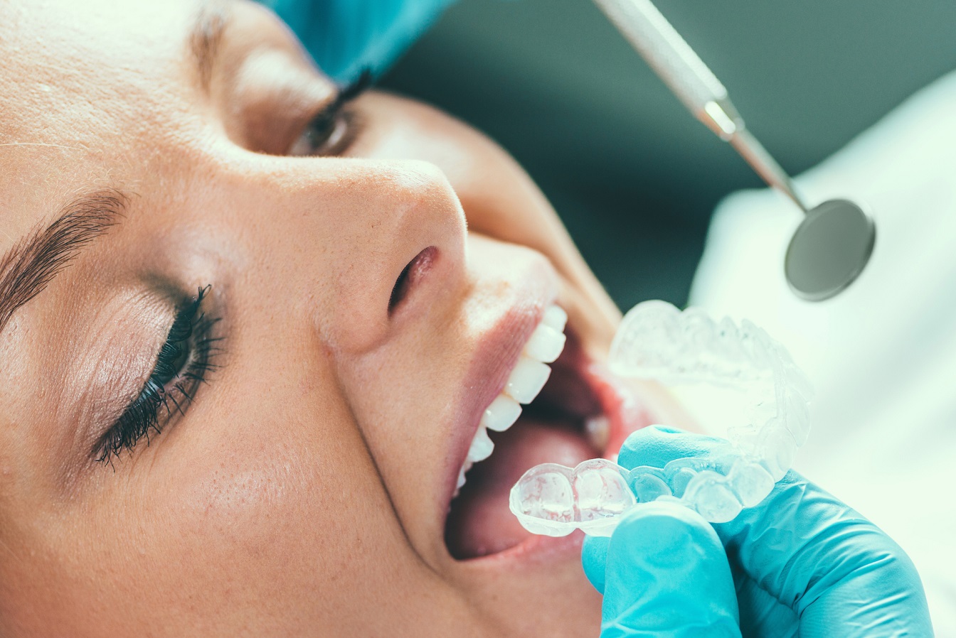 Procedimiento de blanqueamiento dental