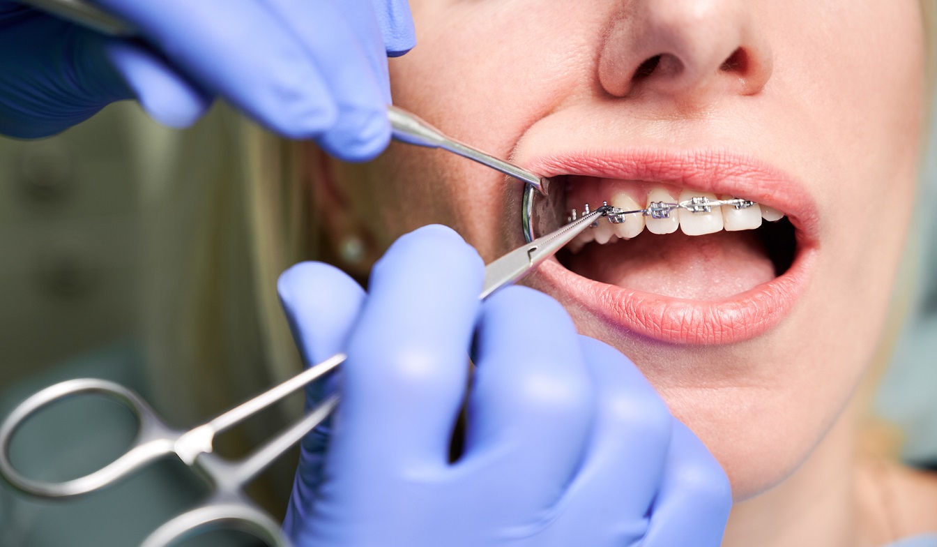 how long do braces hurt?